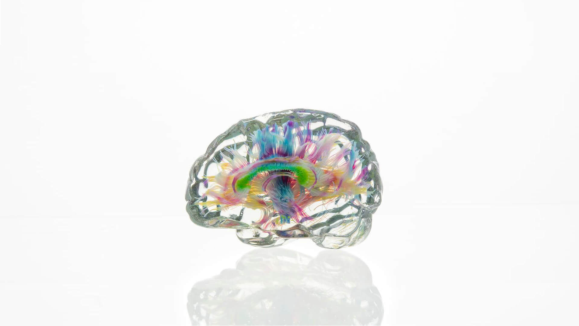 Making Data Matter - 3d printed brain